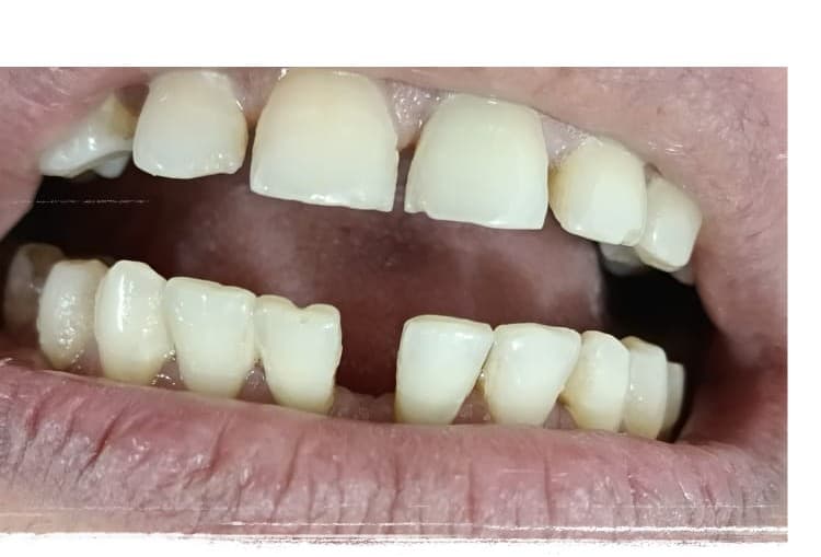 Before treatment