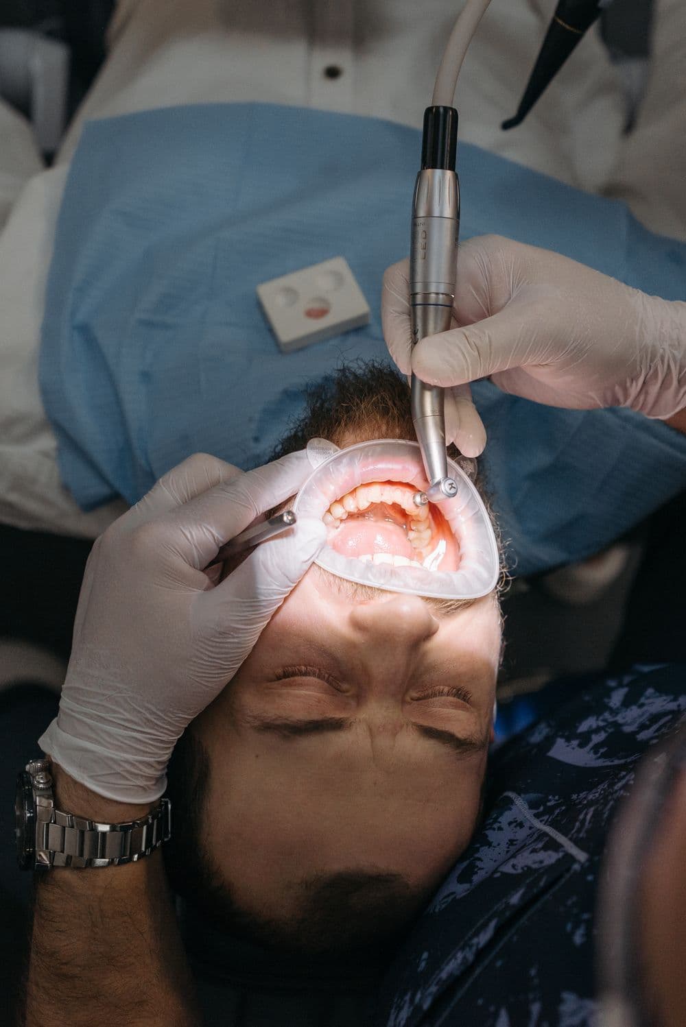 Cosmetic Fillings & Restoration